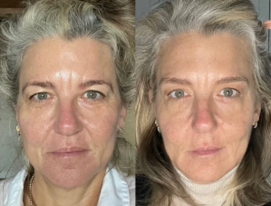 Revéra™ Instant Eye Lift Serum