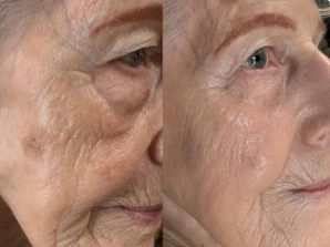 Revéra™ Instant Eye Lift Serum